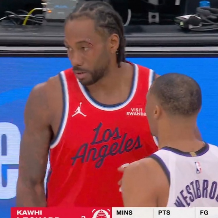 世界杯官方app下载平台-小卡眼角被打破血流不止 回更衣室治疗之后已经重回球场